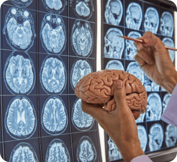 MRI画像と脳の模型